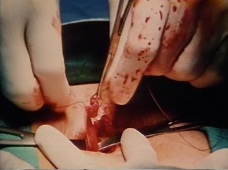 Fig. 1. La operación (The operation), 1982