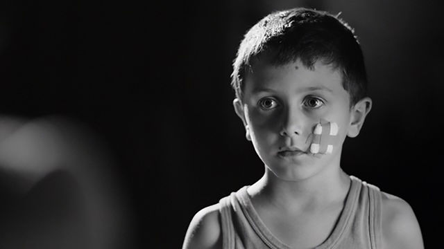 A boy with a bandage on his cheek